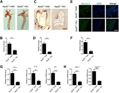 Sivelestat Alleviates Atherosclerosis by Improving Intestinal Barrier Function and Reducing Endotoxemia